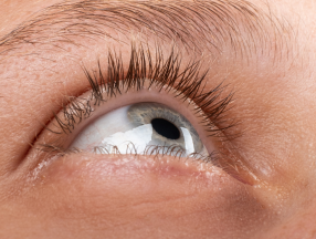 Corneal Ulcer Close-up